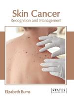 Skin Cancer: Recognition and Management