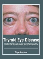 Thyroid Eye Disease: Understanding Graves' Ophthalmopathy