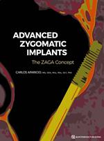 Advanced Zygomatic Implants