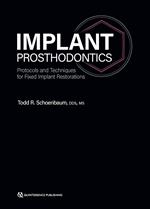 Implant Prosthodontics