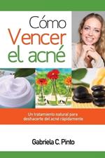 Como Vencer el Acne: Un tratamiento natural para deshacerte del acne rapidamente