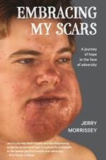 Embracing My Scars: A journey of hope in the face of adversity