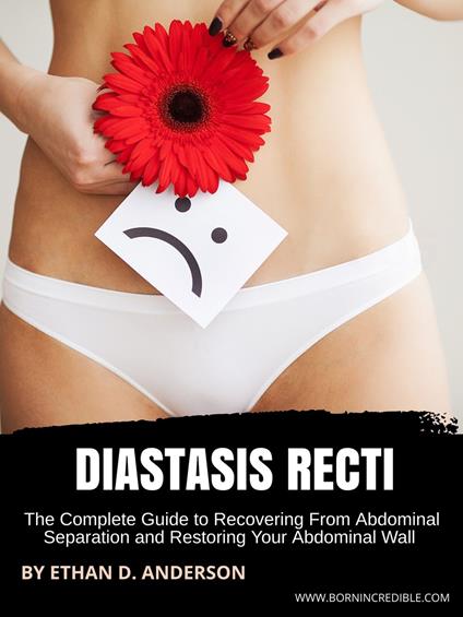 Diastasis Recti