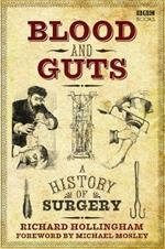 Blood and Guts: A History of Surgery