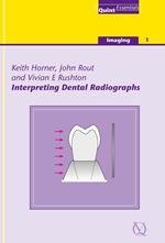 Interpreting Dental Radiographs