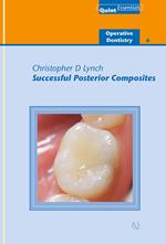 Successful Posterior Composites