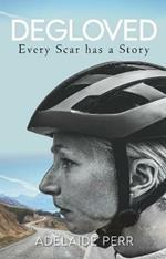 Degloved: Every Scar has a Story