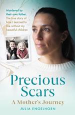 Precious Scars