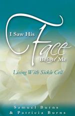 I Saw His Face Before Me - Living with Sickle Cell Anemia