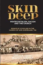 Skin Deep: Pentecostalism, Racism and the Church: