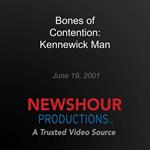 Bones of Contention: Kennewick Man