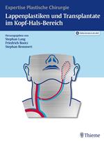 Lappenplastiken und Transplantate im Kopf-Hals-Bereich