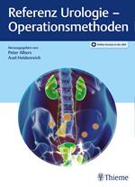 Referenz Urologie - Operationsmethoden