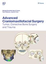 Advanced Craniomaxillofacial Surgery