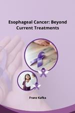 Esophageal Cancer: Beyond Current Treatments