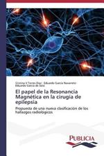 El papel de la Resonancia Magnetica en la cirugia de epilepsia