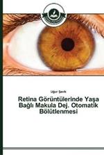 Retina Goeruntulerinde Yasa Bagli Makula Dej. Otomatik Boelutlenmesi