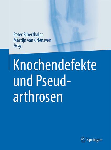 Knochendefekte und Pseudarthrosen