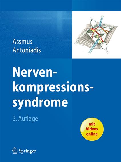 Nervenkompressionssyndrome