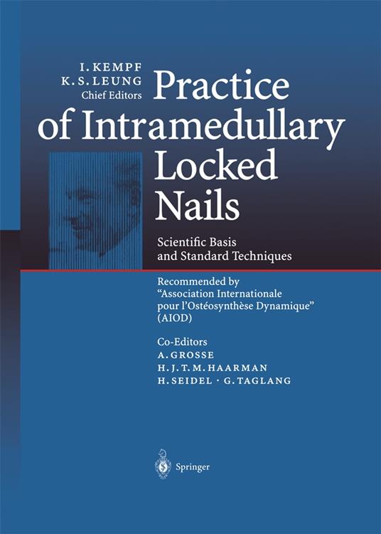 Practice of Intramedullary Locked Nails