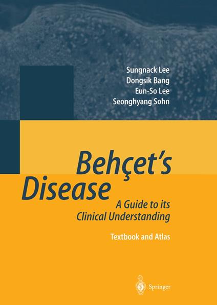 Behçet’s Disease