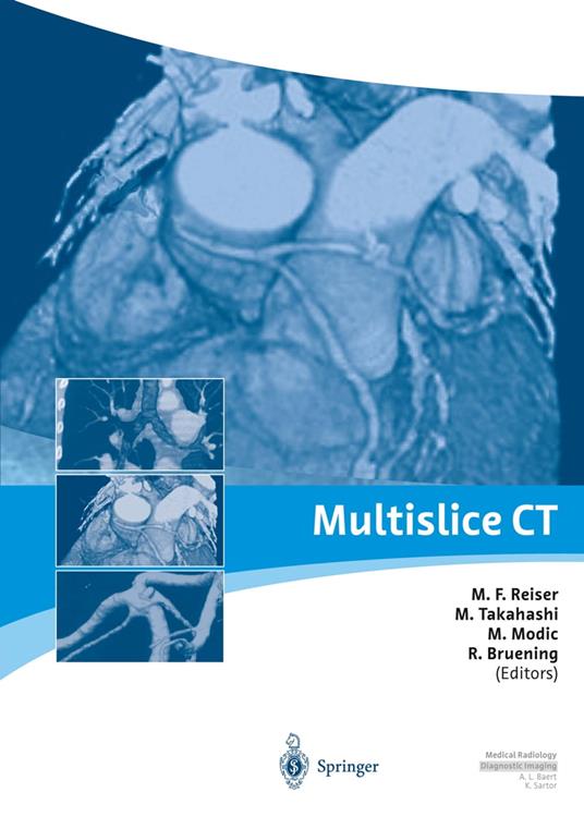 Multislice CT