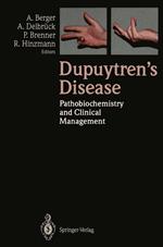 Dupuytren’s Disease