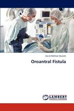 Oroantral Fistula