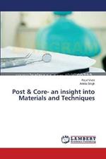 Post & Core- an insight into Materials and Techniques