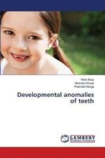 Developmental anomalies of teeth