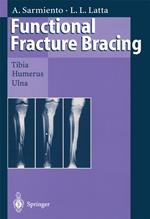 Functional Fracture Bracing