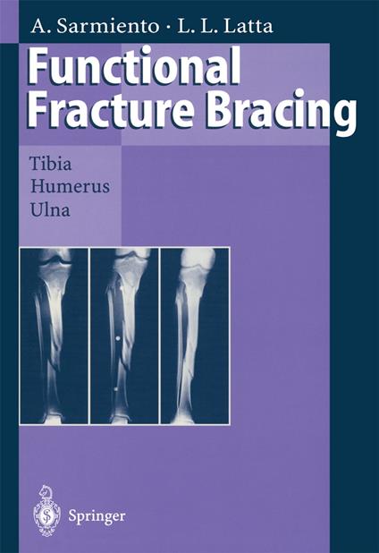 Functional Fracture Bracing