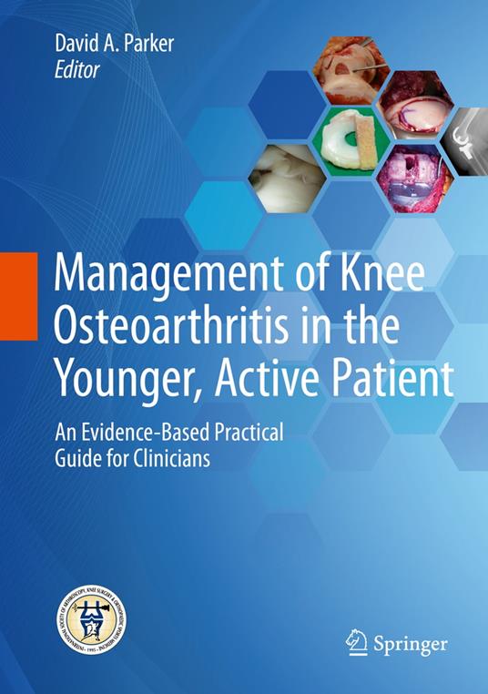 Management of Knee Osteoarthritis in the Younger, Active Patient