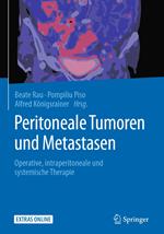 Peritoneale Tumoren und Metastasen