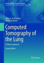 Computed Tomography of the Lung: A Pattern Approach