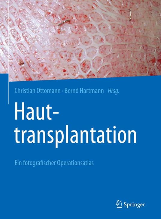 Hauttransplantation