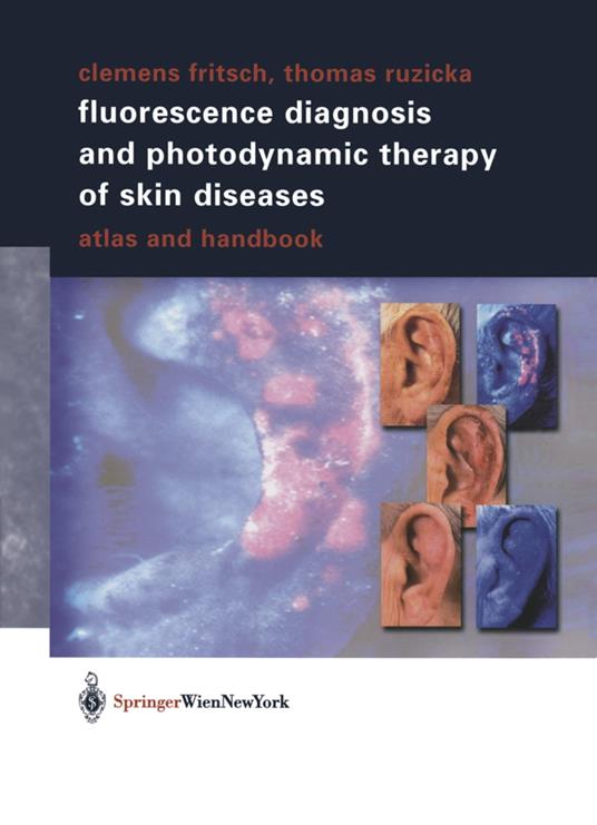 Fluorescence Diagnosis and Photodynamic Therapy of Skin Diseases