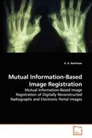 Mutual Information-Based Image Registration