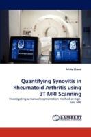 Quantifying Synovitis in Rheumatoid Arthritis using 3T MRI Scanning