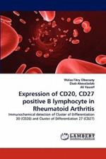 Expression of CD20, CD27 positive B lymphocyte in Rheumatoid Arthritis