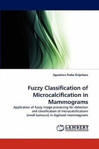 Fuzzy Classification of Microcalcification in Mammograms - Agustinus Praba Drijarkara - cover