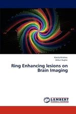 Ring Enhancing Lesions on Brain Imaging