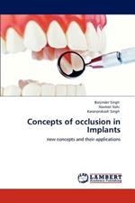 Concepts of occlusion in Implants