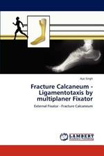 Fracture Calcaneum - Ligamentotaxis by multiplaner Fixator