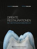 Direkte Restaurationen im Seitenzahnbereich