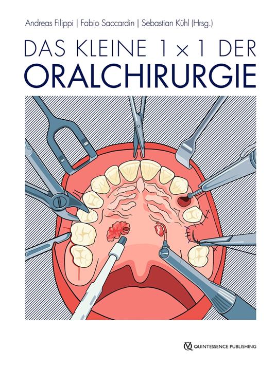 Das kleine 1 x 1 der Oralchirurgie