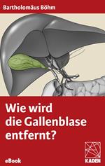 Wie wird die Gallenblase entfernt?