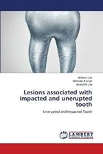 Lesions associated with impacted and unerupted tooth