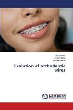 Evolution of orthodontic wires