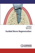 Guided Bone Regeneration